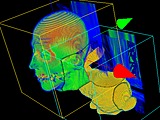 First try at rendering intersecting volumes by breaking them up into pieces.  Two BooleanXor nodes and one BooleanAnd node create the pieces.  Here blending is a problem because each piece blends its result into the default framebuffer, whereas they should really be picking up where the one behind it left off.  Then only when all the pieces are done should the results be sent to the screen.