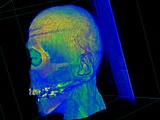 Stanford CT Head dataset with a transfer function to bring out the details.